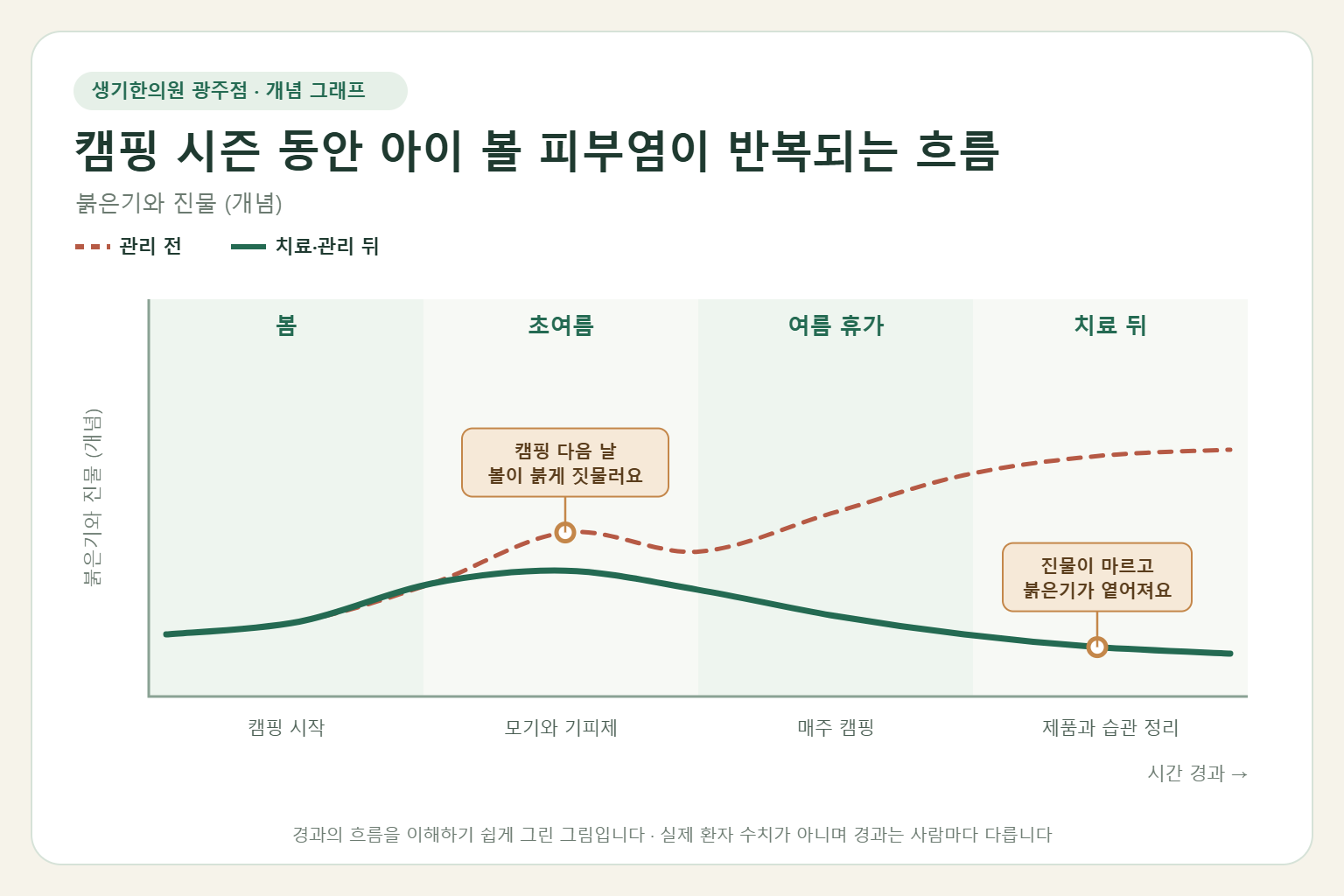 캠핑 시즌 동안 아이 볼 피부염이 반복되는 흐름과 치료 뒤 변화를 그린 개념 그래프