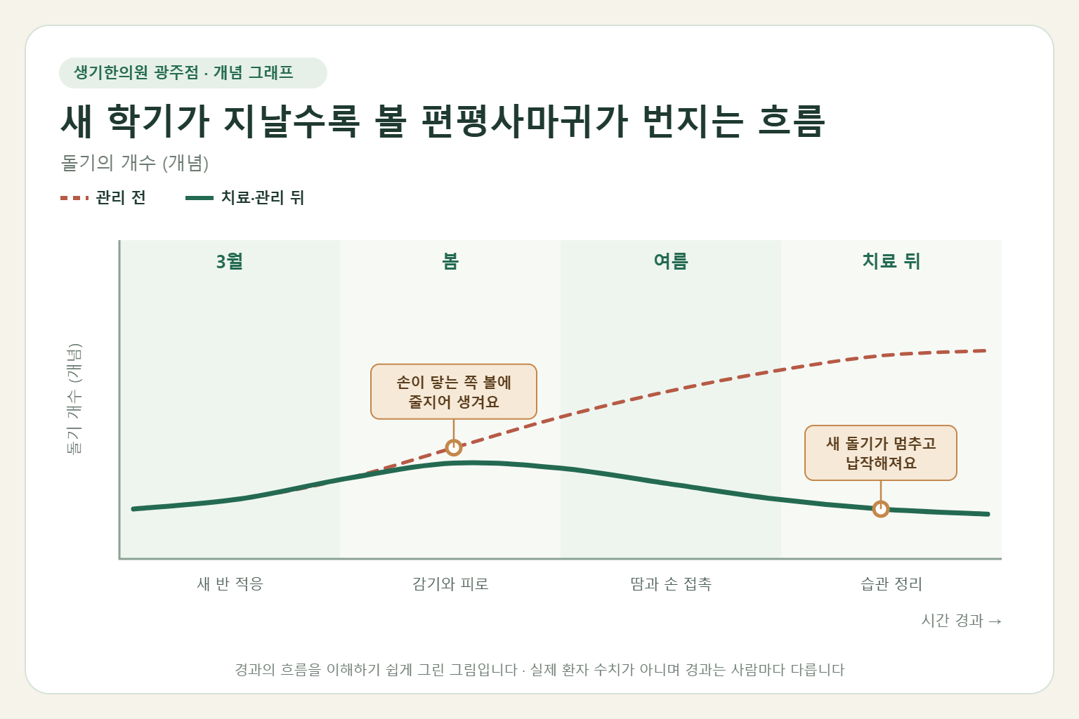 새 학기가 지날수록 볼 편평사마귀가 번지는 흐름과 치료 뒤 변화를 그린 개념 그래프