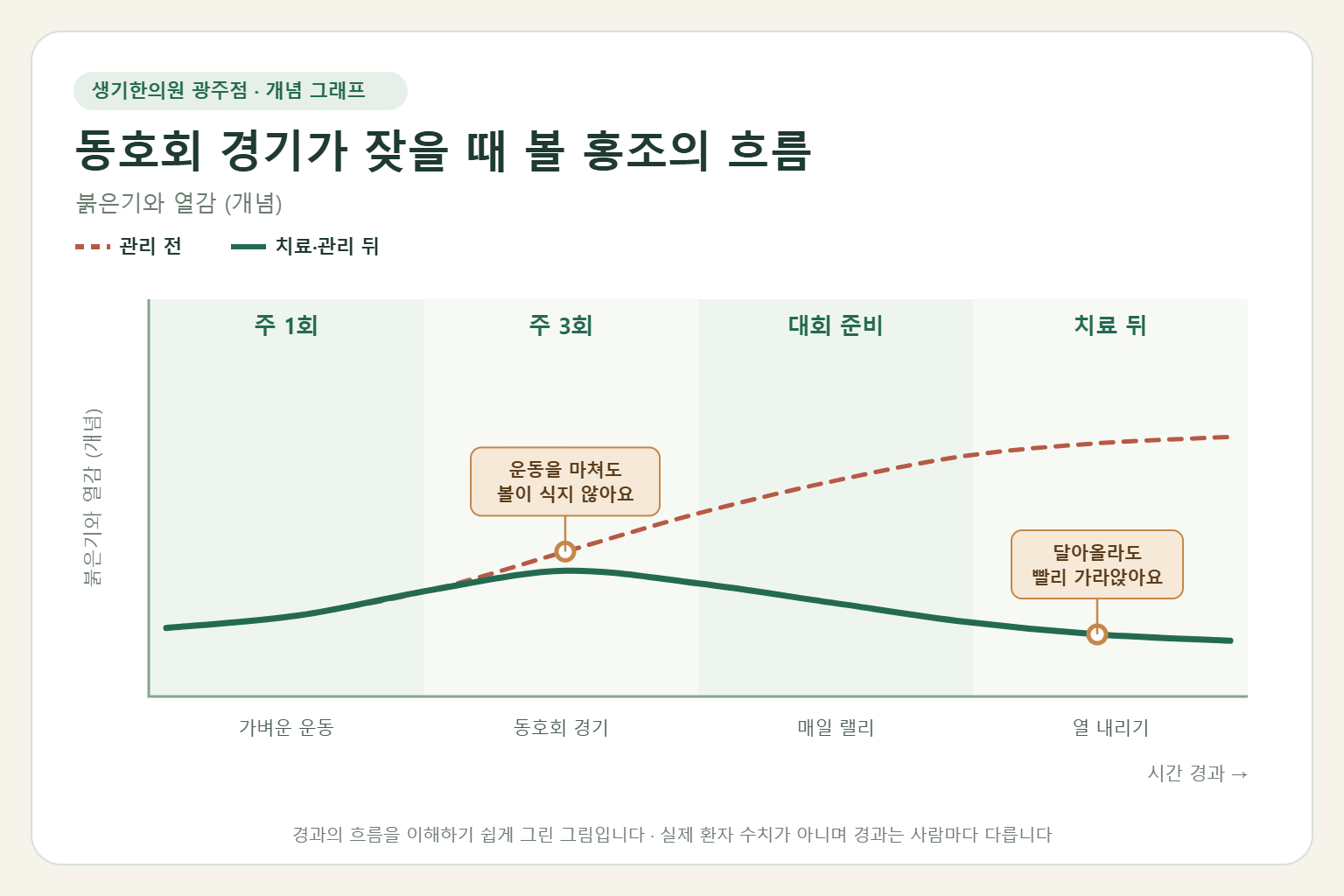 동호회 경기가 잦을 때 볼 홍조의 흐름과 치료 뒤 변화를 그린 개념 그래프