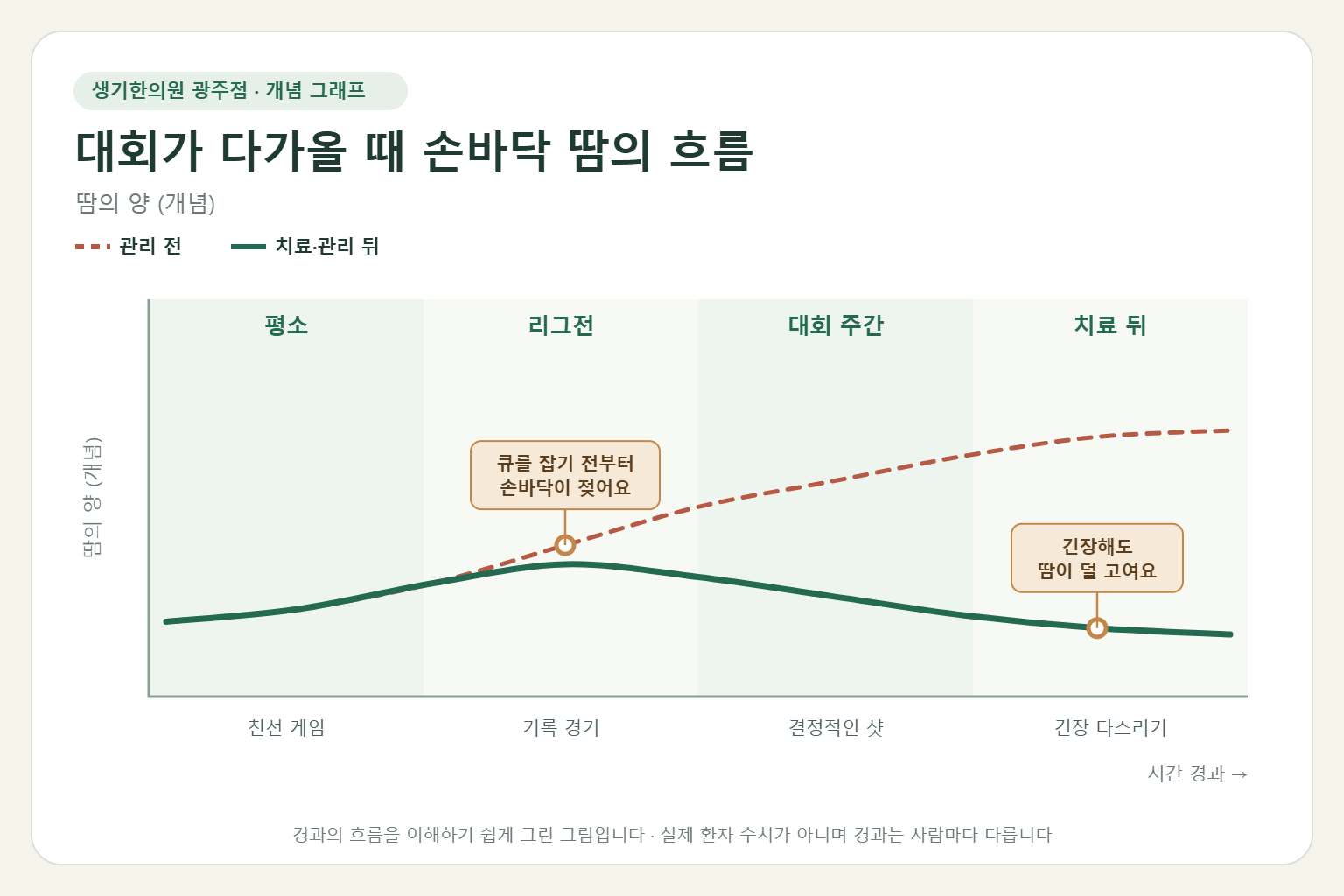 대회가 다가올 때 손바닥 땀의 흐름과 치료 뒤 변화를 그린 개념 그래프