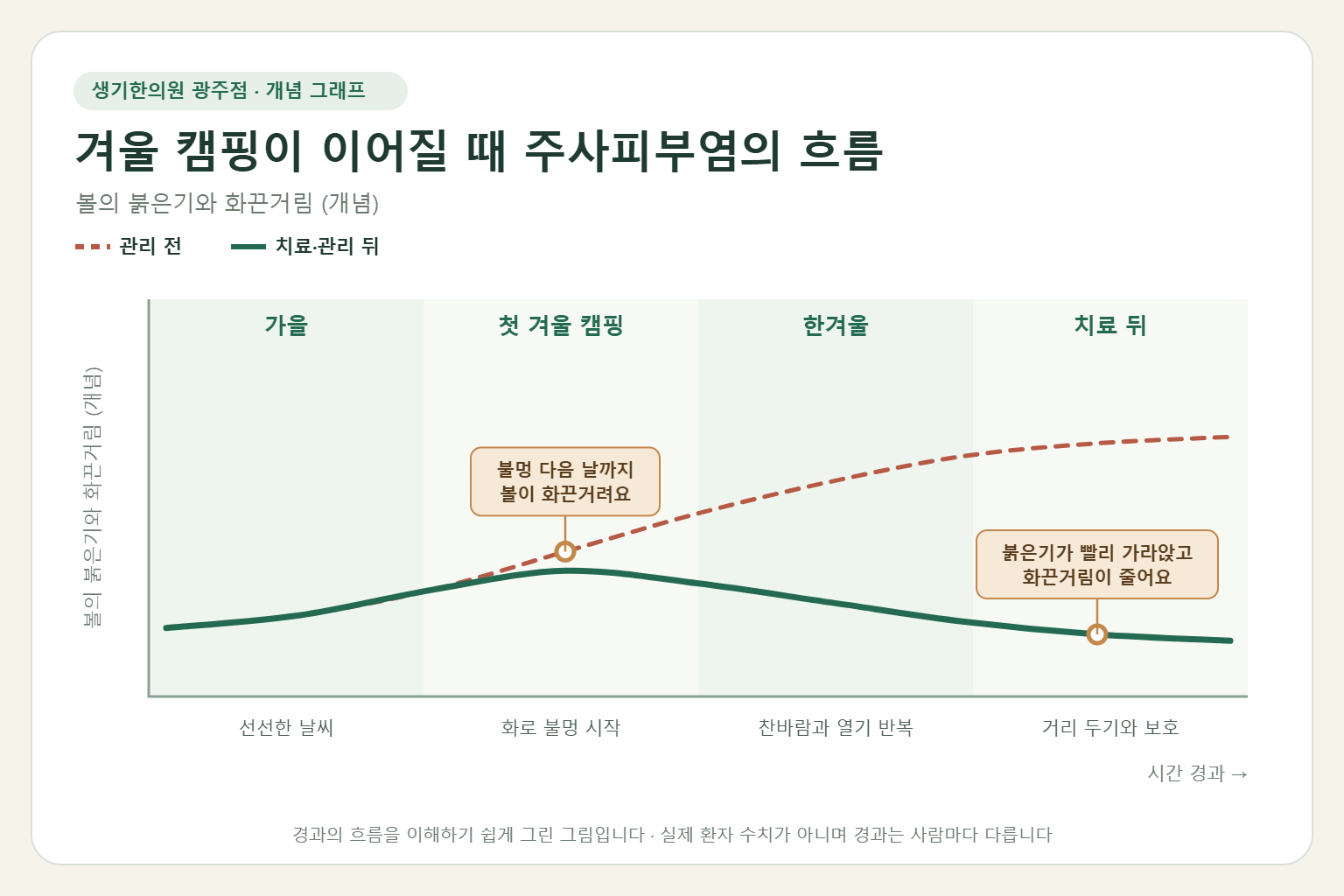겨울 캠핑이 이어질 때 주사피부염의 흐름과 치료 뒤 변화를 그린 개념 그래프