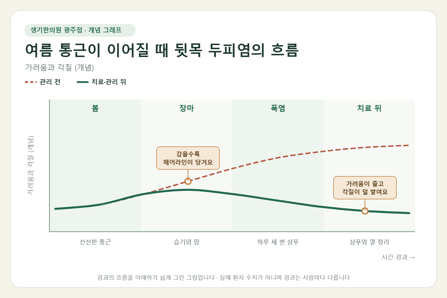 여름 통근이 이어질 때 뒷목 두피염의 흐름과 치료 뒤 변화를 그린 개념 그래프