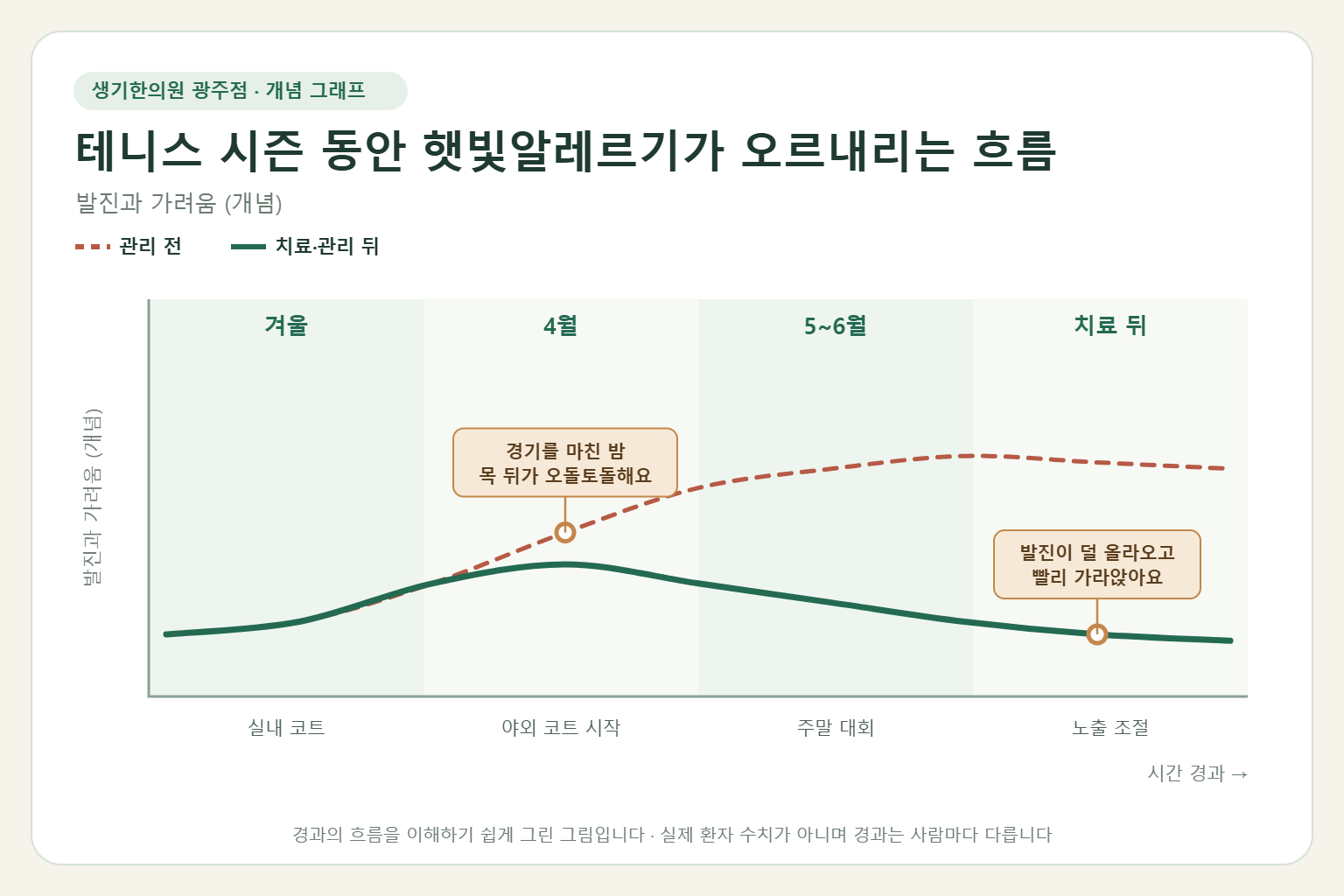 테니스 시즌 동안 햇빛알레르기가 오르내리는 흐름과 치료 뒤 변화를 그린 개념 그래프