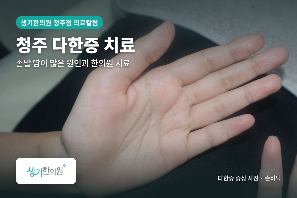 손바닥 다한증 증상 사진과 문구 「청주 다한증 치료, 손발 땅이 많은 원인과 한의원 치료 · 생기한의원 청주점」
