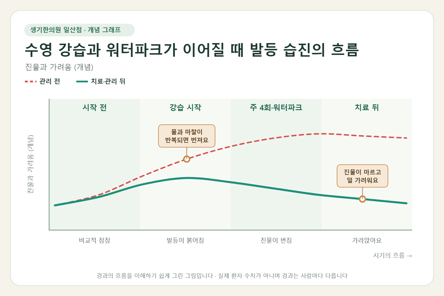 수영 강습과 워터파크가 이어질 때 발등 습진이 오르내리는 흐름 개념 그래프