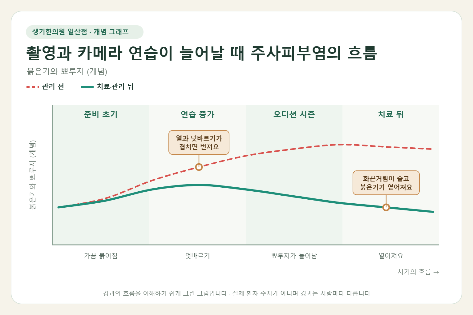 촬영과 카메라 연습이 늘어날 때 주사피부염이 오르내리는 흐름 개념 그래프
