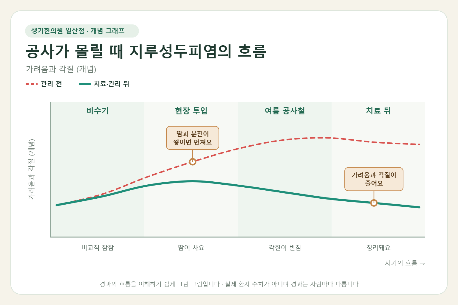 공사가 몰릴 때 지루성두피염이 오르내리는 흐름 개념 그래프