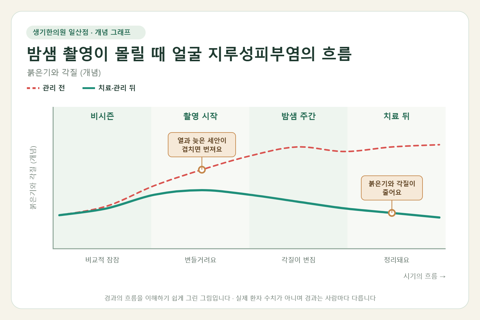 밤샘 촬영이 몰릴 때 얼굴 지루성피부염이 오르내리는 흐름 개념 그래프
