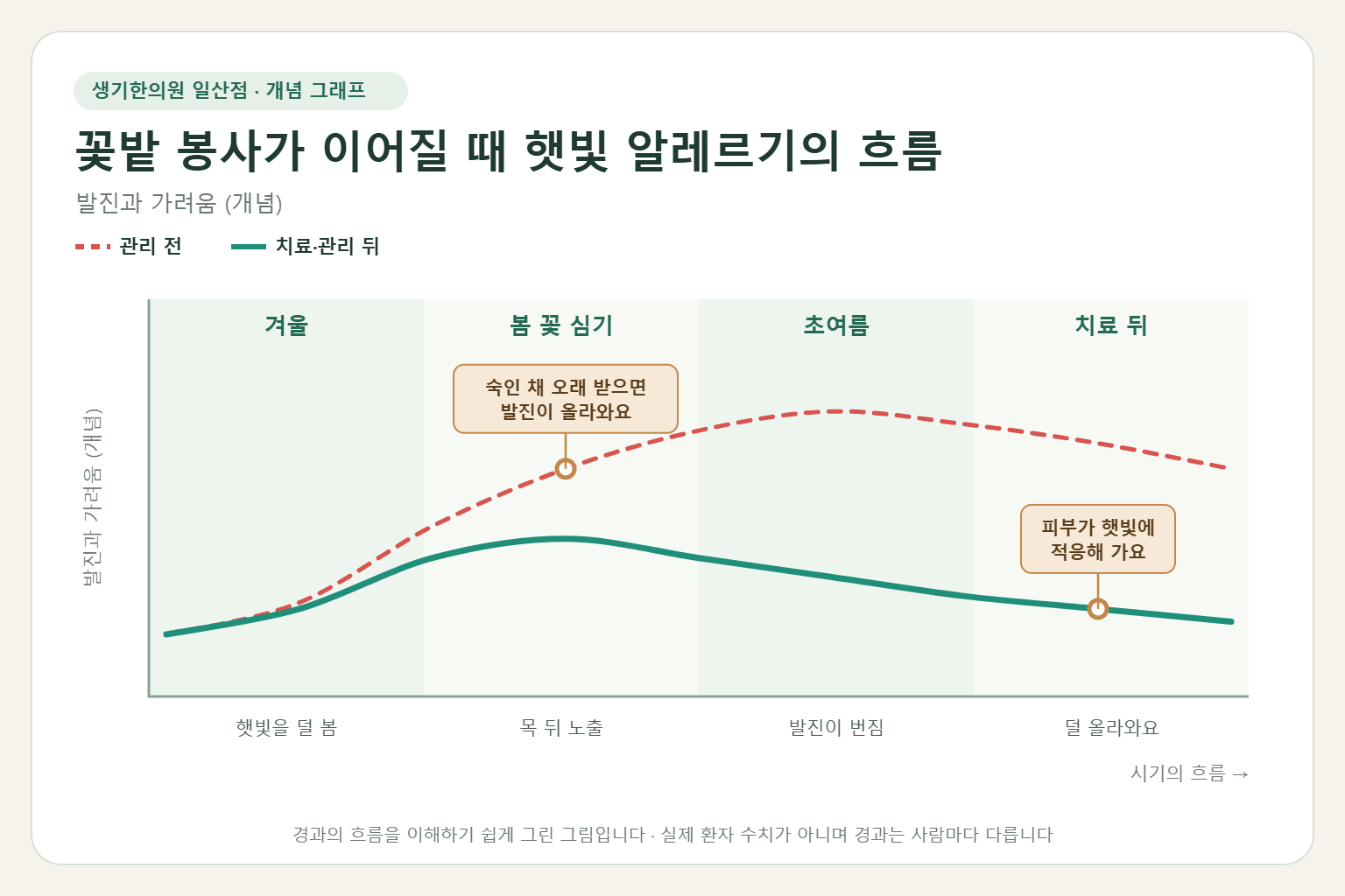 꽃밭 봉사가 이어질 때 햇빛 알레르기가 오르내리는 흐름 개념 그래프