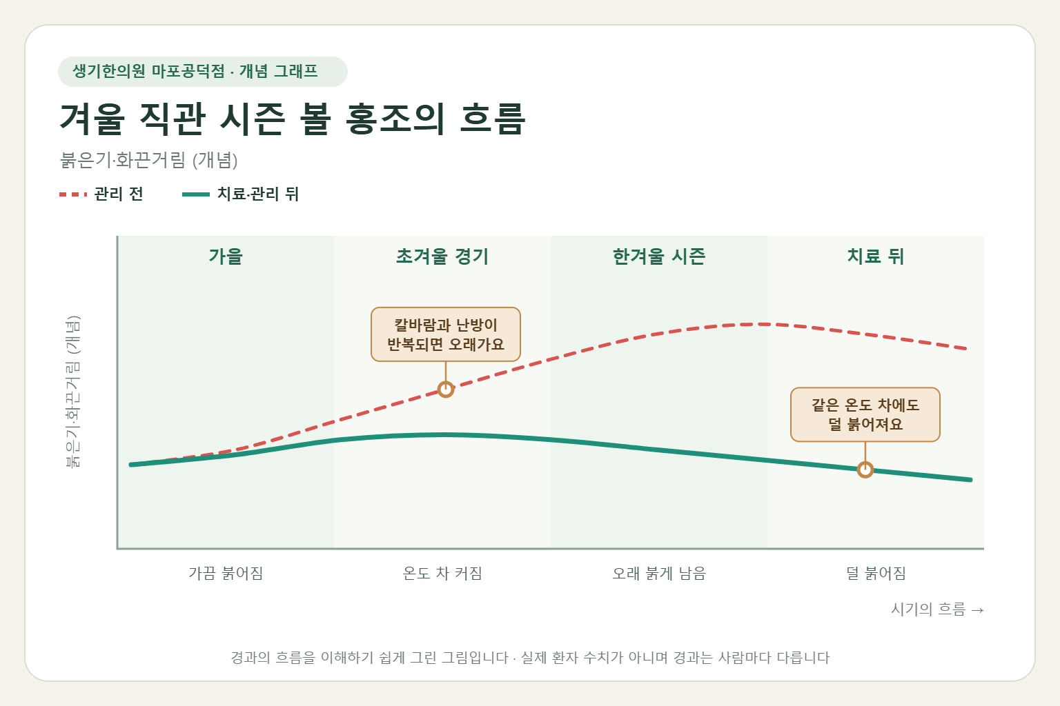 겨울 직관 시즌에 볼 홍조가 오르내리는 흐름 개념 그래프