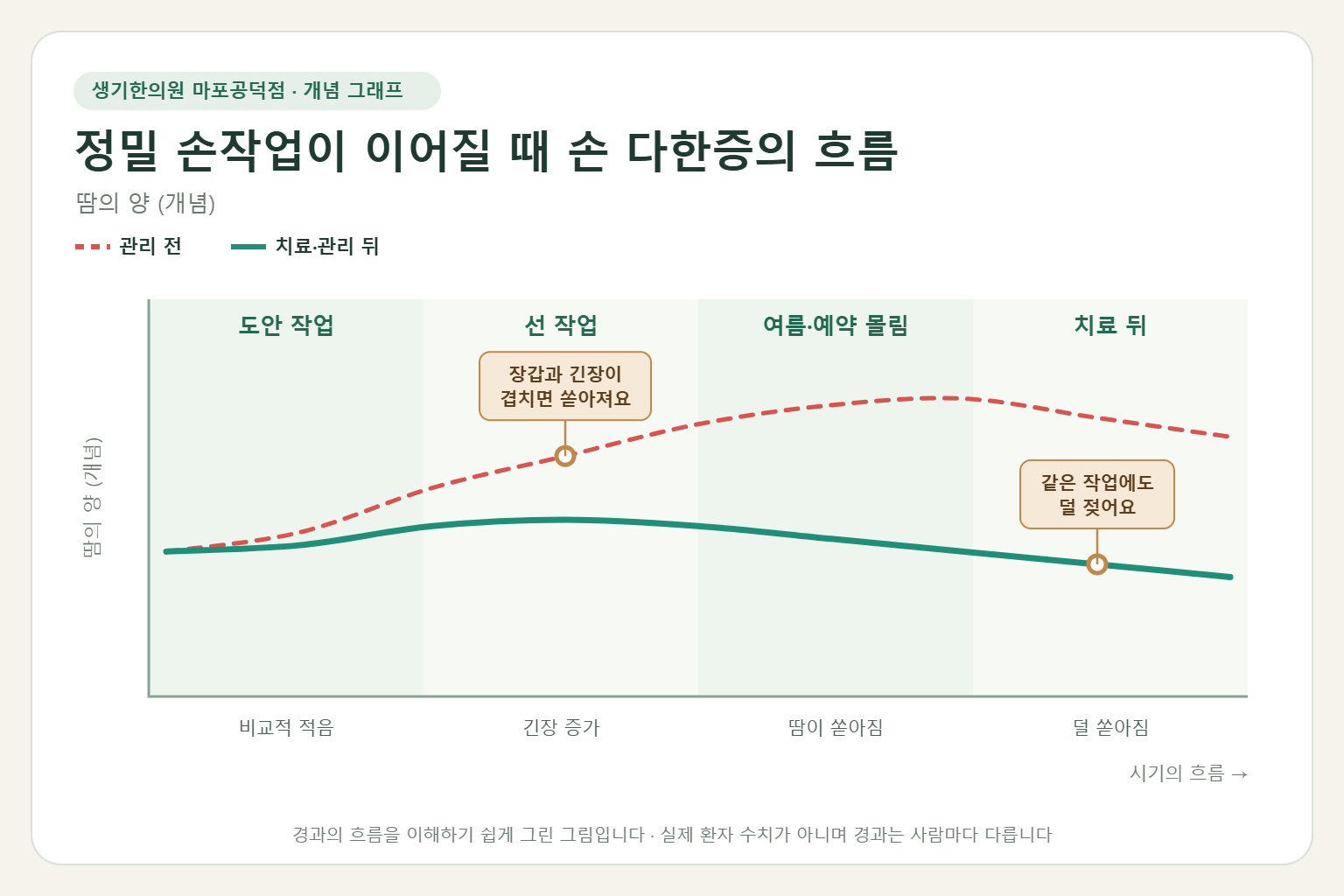 정밀 손작업이 이어질 때 손 다한증이 오르내리는 흐름 개념 그래프