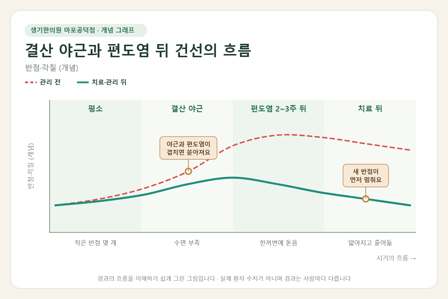 결산 야근과 편도염 뒤 건선이 오르내리는 흐름 개념 그래프