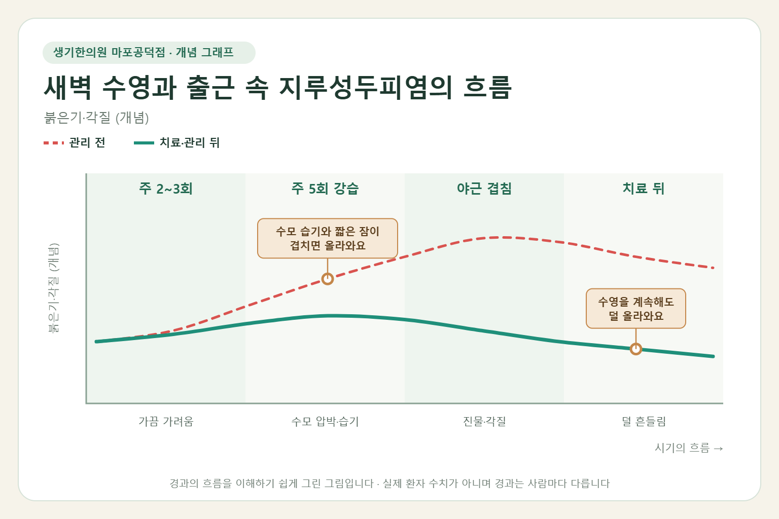 새벽 수영과 출근이 이어질 때 지루성두피염이 오르내리는 흐름 개념 그래프