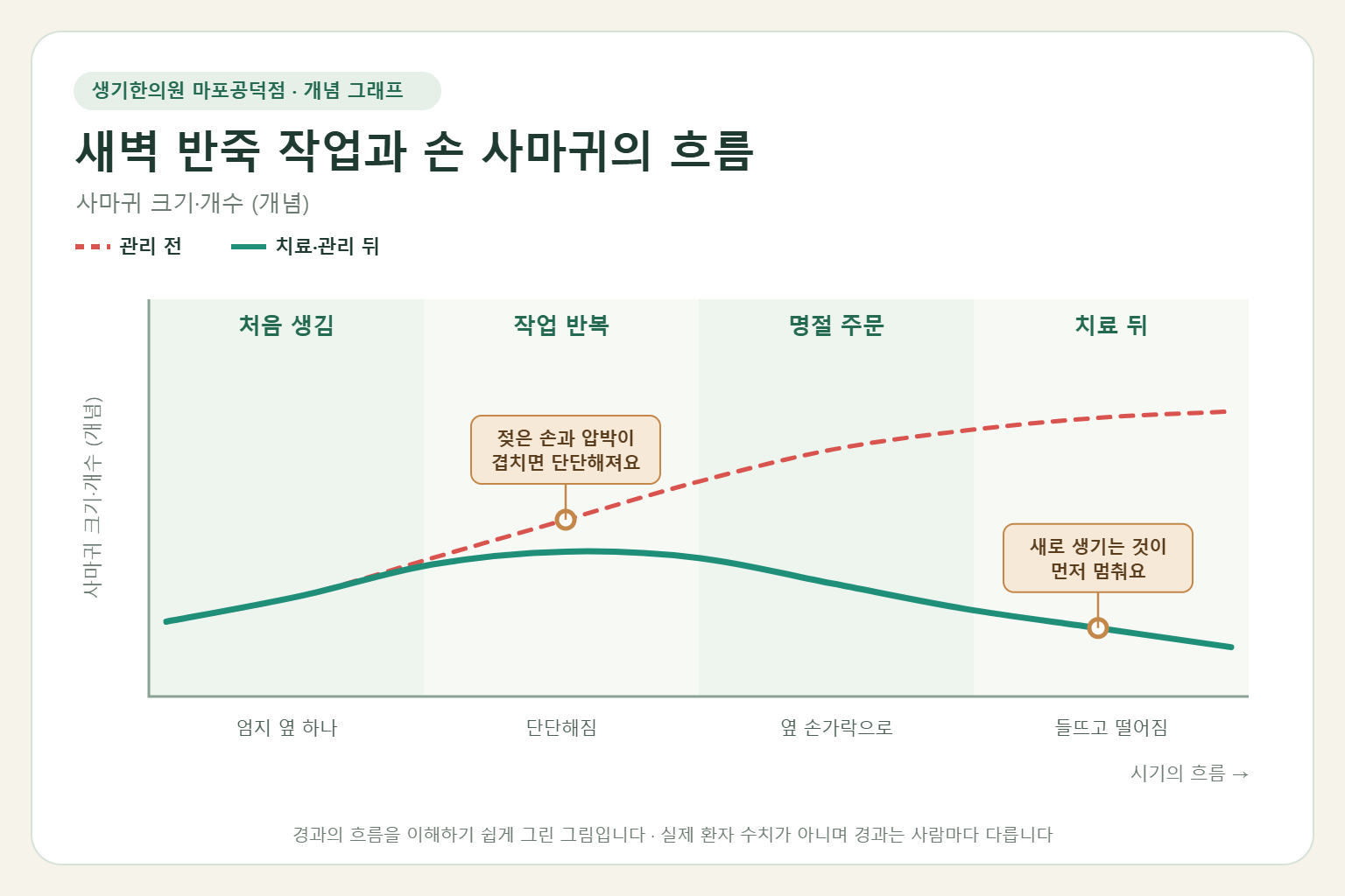 새벽 반죽 작업이 이어질 때 손 사마귀가 단단해지는 흐름 개념 그래프