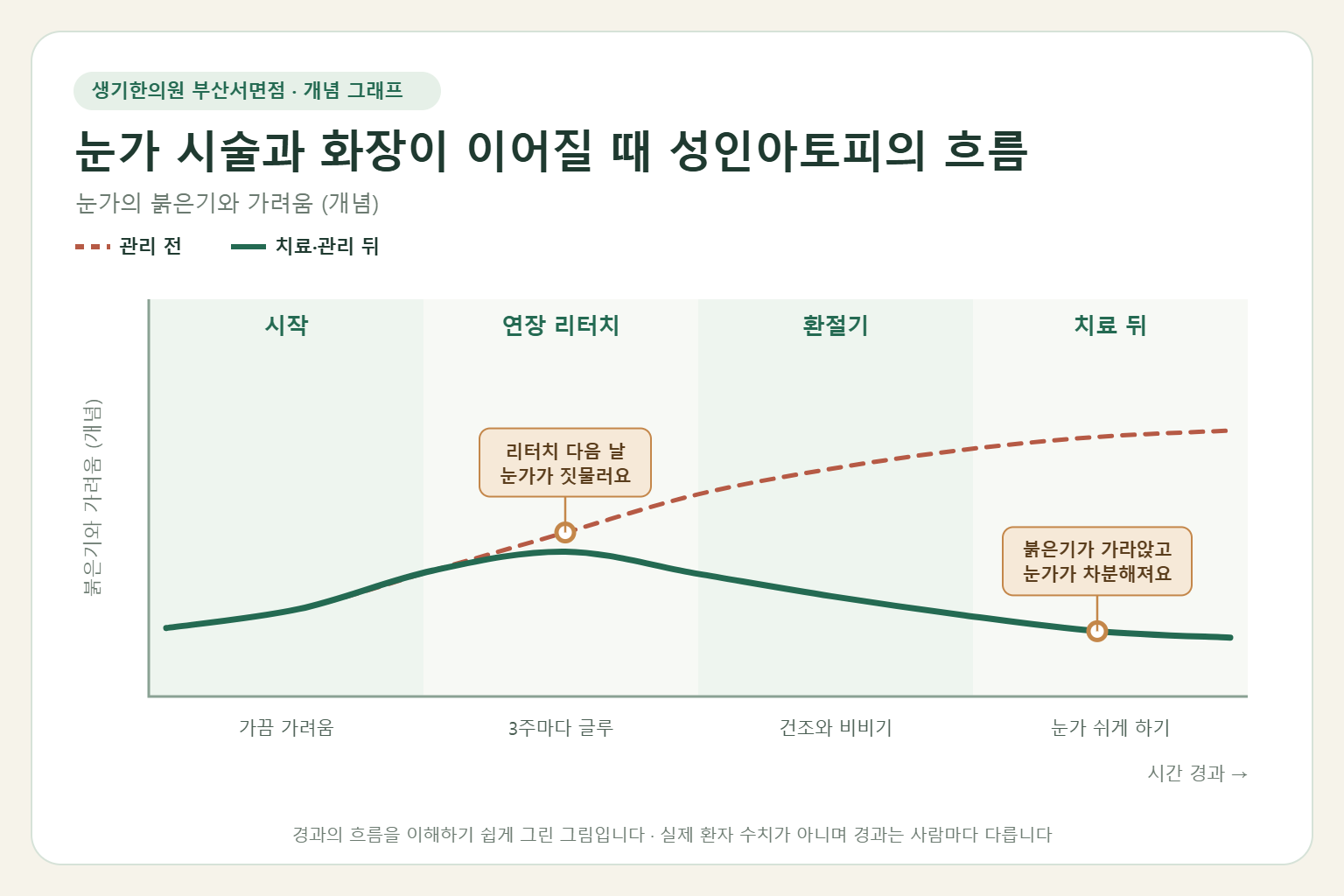 눈가 시술과 화장이 이어질 때 성인아토피의 흐름과 치료 뒤 변화를 그린 개념 그래프