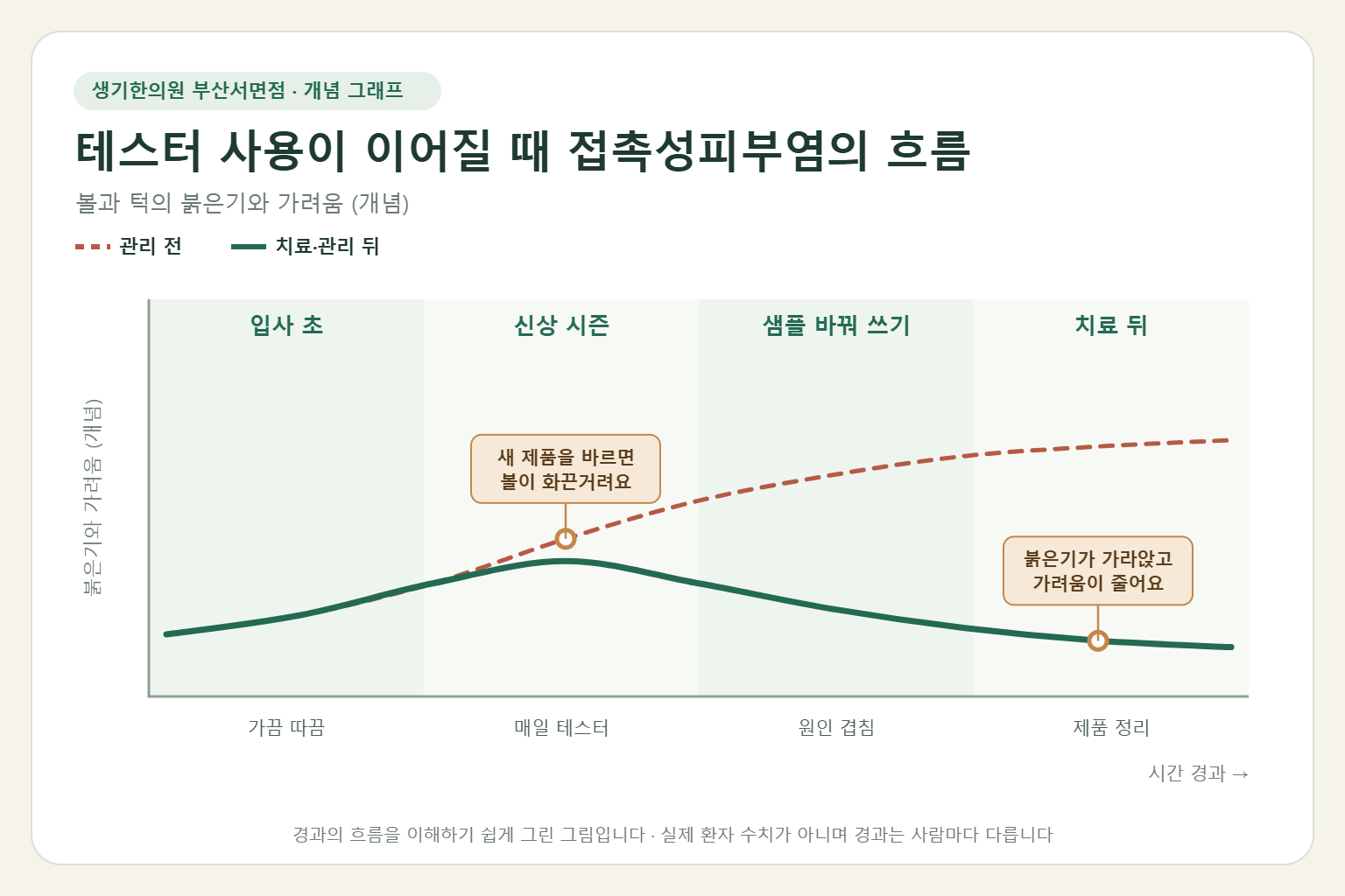 테스터 사용이 이어질 때 접촉성피부염의 흐름과 치료 뒤 변화를 그린 개념 그래프