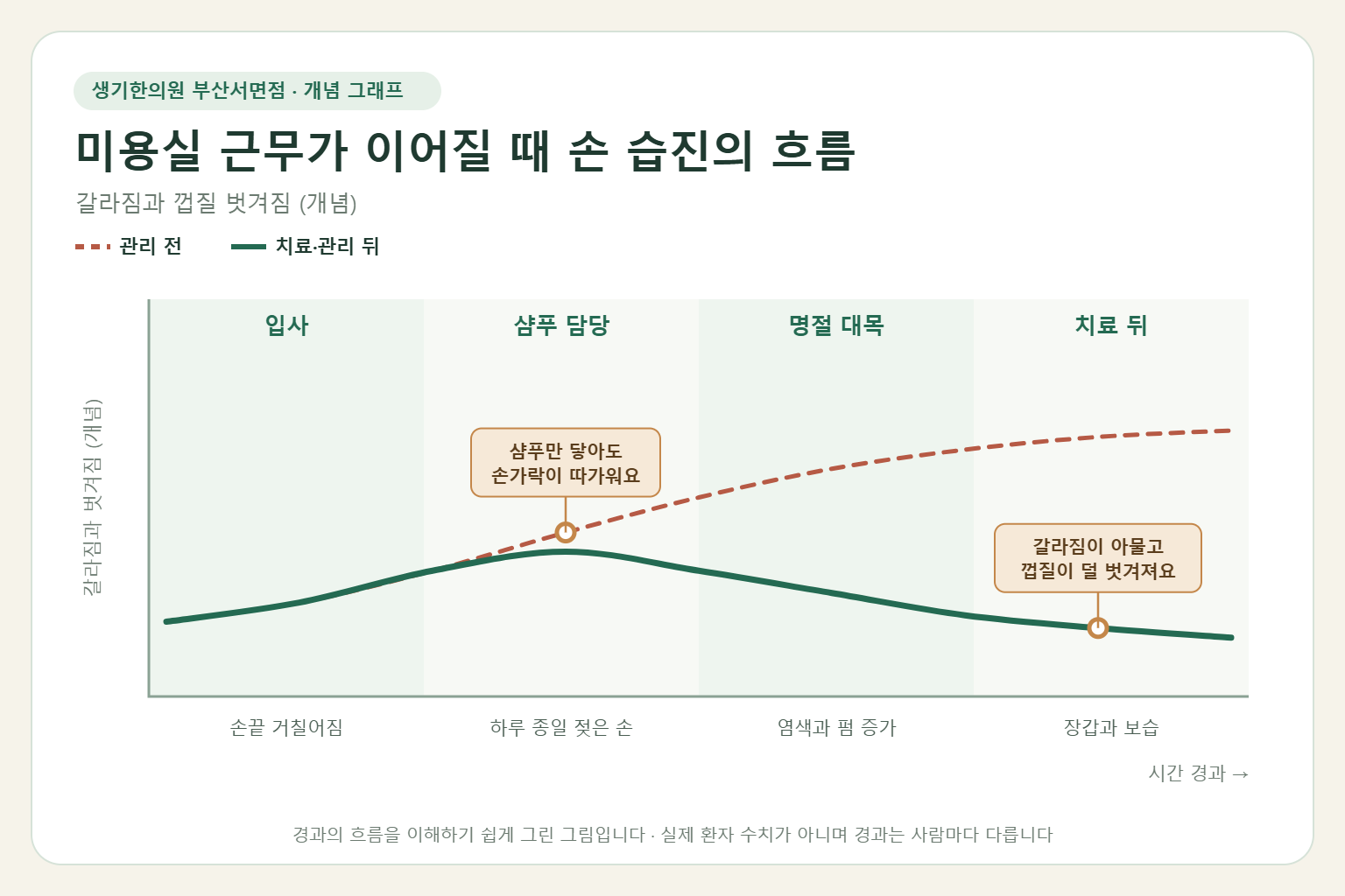미용실 근무가 이어질 때 손 습진의 흐름과 치료 뒤 변화를 그린 개념 그래프