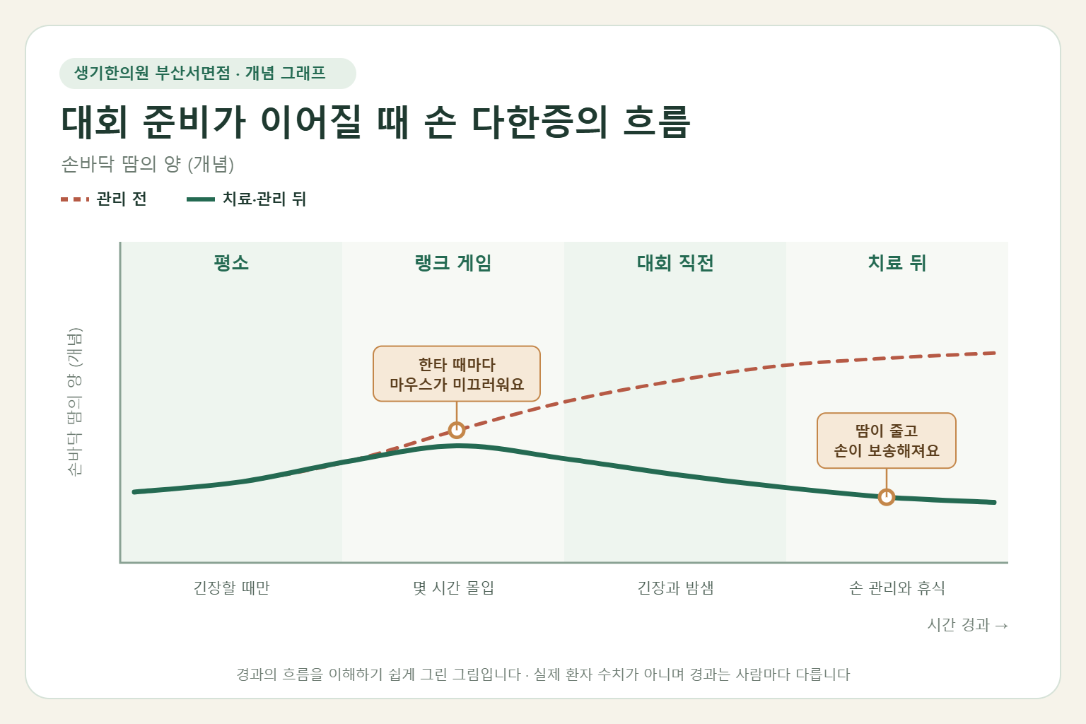 대회 준비가 이어질 때 손 다한증의 흐름과 치료 뒤 변화를 그린 개념 그래프