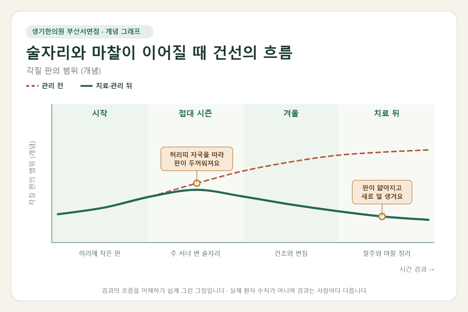 술자리와 마찰이 이어질 때 건선의 흐름과 치료 뒤 변화를 그린 개념 그래프