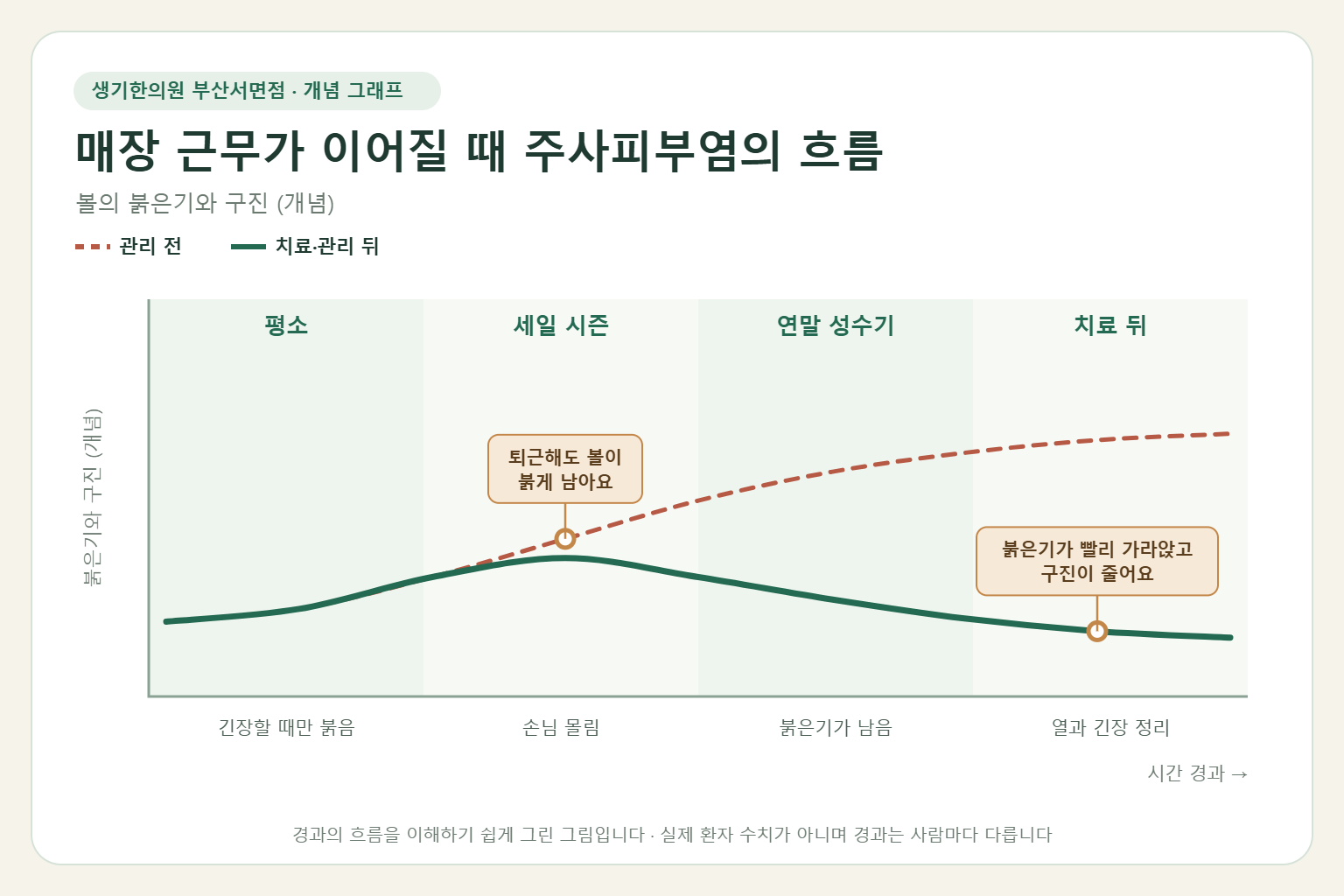 매장 근무가 이어질 때 주사피부염의 흐름과 치료 뒤 변화를 그린 개념 그래프