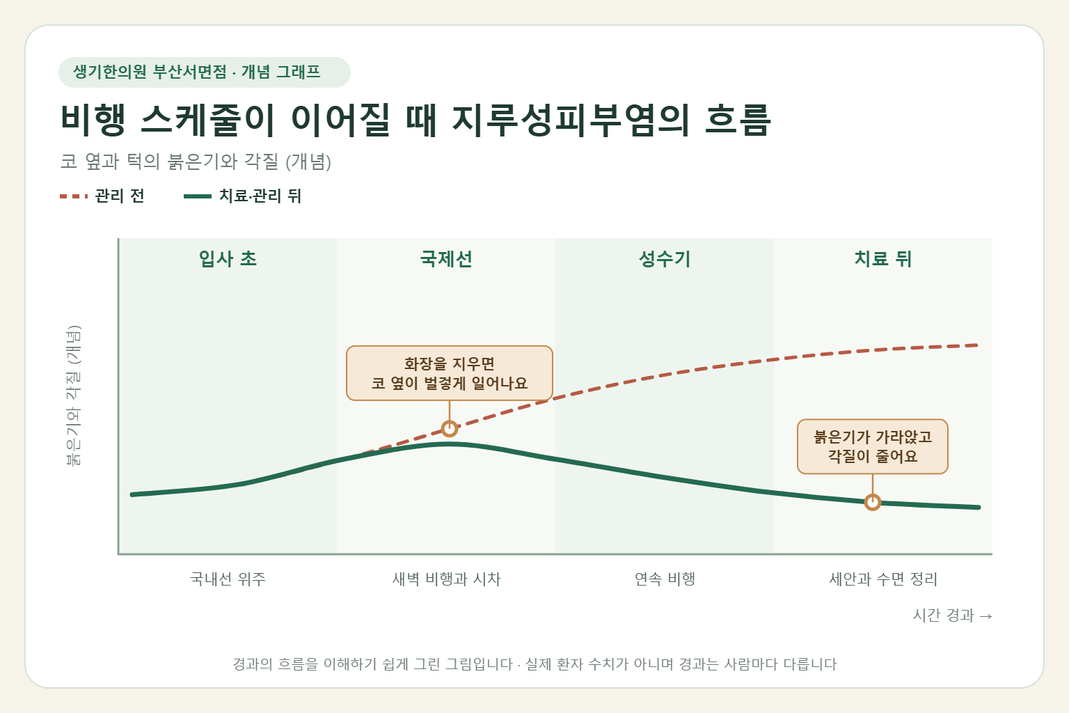 비행 스케줄이 이어질 때 지루성피부염의 흐름과 치료 뒤 변화를 그린 개념 그래프