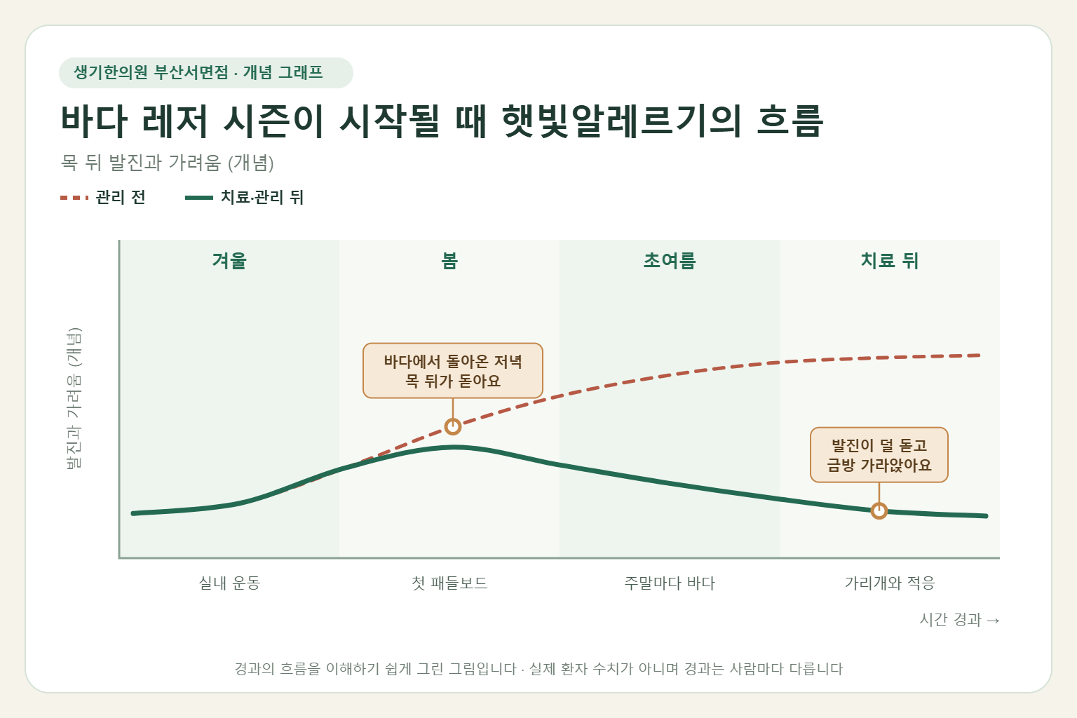 바다 레저 시즌이 시작될 때 햇빛알레르기의 흐름과 치료 뒤 변화를 그린 개념 그래프