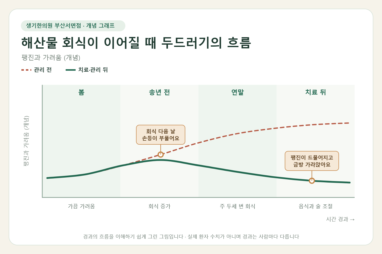 해산물 회식이 이어질 때 두드러기의 흐름과 치료 뒤 변화를 그린 개념 그래프
