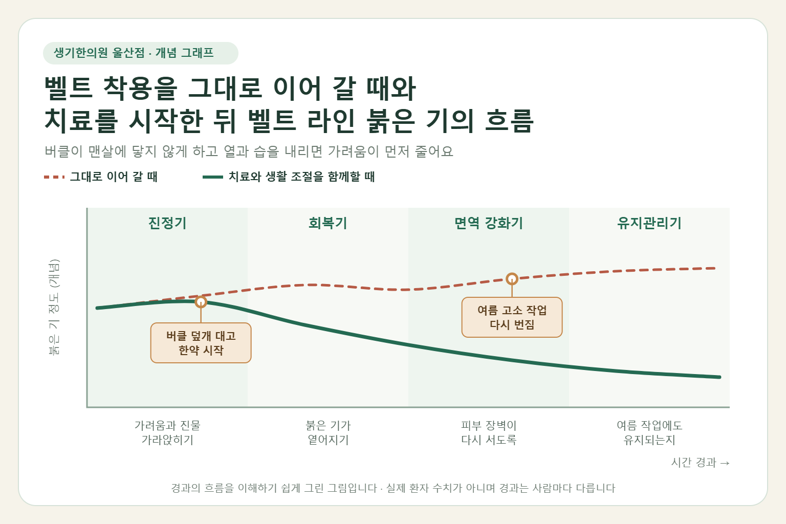 울산 접촉성피부염 경과 개념 그래프 — 벨트 착용을 그대로 이어 갈 때와 한약 치료와 생활 조절을 함께할 때 벨트 라인 붉은 기의 흐름 비교